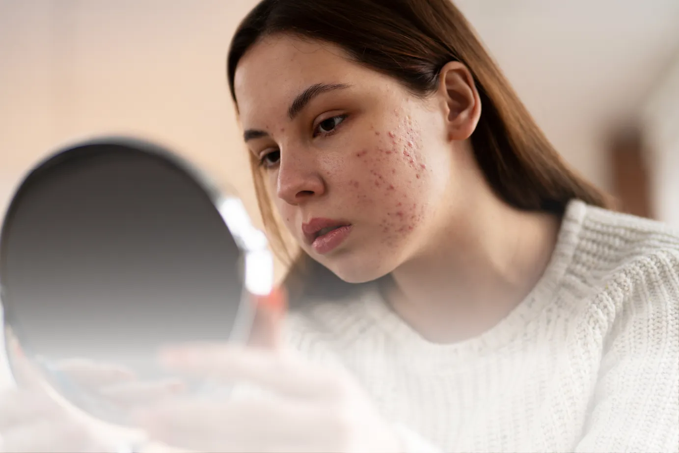 آشنایی با 3 مورد از شایع ترین اختلالات و مشکلات پوستی